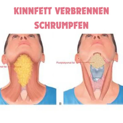 Vorschaubild 11