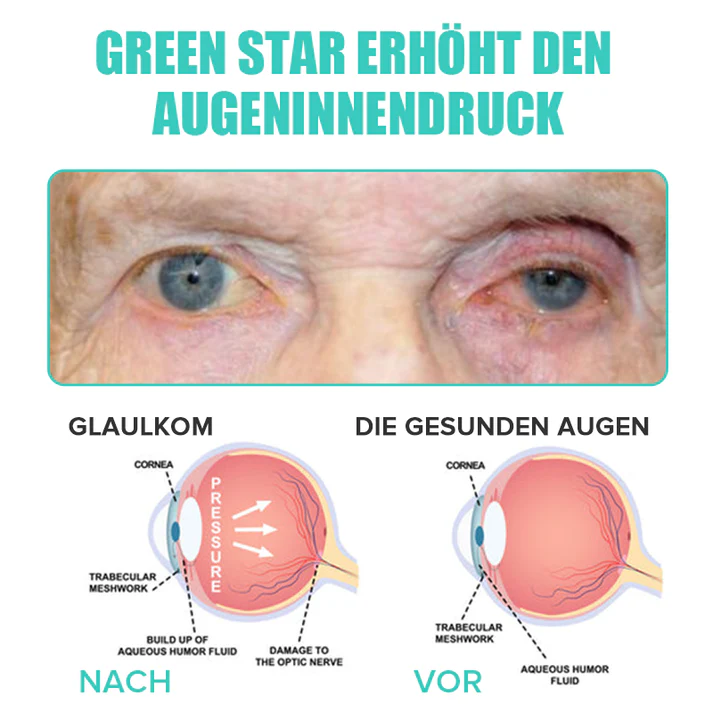 Vorschaubild 8